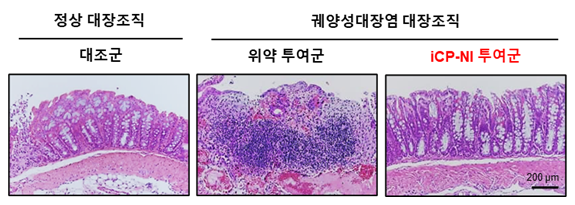 사진설명: iCP-NI의 염증성장질환 치료효능: 궤양성대장염 동물모델에서 대장 점막 및 막하층이 뭉게진 (가운데) 반면, iCP-NI 투여군에서는 장 점막층 전체 구조가 정상조직 (왼쪽)과 유사하게 회복됨 (오른쪽)］