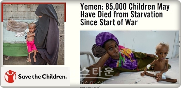 세이브 더 칠드런의 예멘 대표는  2015년 4월부터 2018년 10월까지 유엔의 데이터를 분석한 결과 이 같은 수치가 파악됐다고 말하고, “울지 못할 만큼 허약한 아이들도 있다”면서 “부모들은 깡마른 아이들을 눈뜨고 볼 수 없을 정도의 아이들도 있다”며 국제사회의 지원을 호소했다.