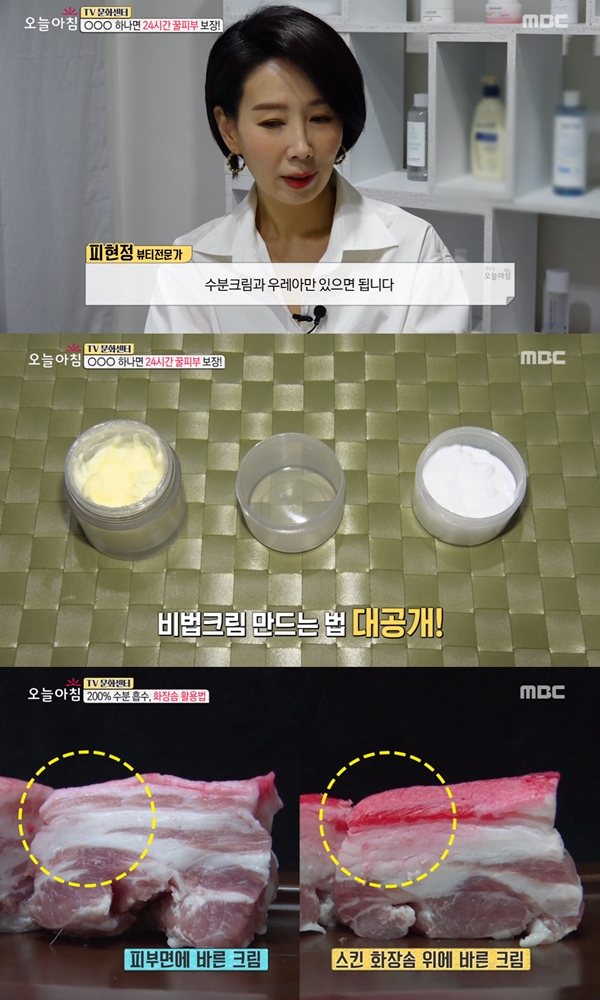 우레아 크림 (사진: MBC '생방송 오늘아침')