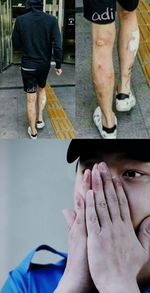 박유천 다리, 메스버그 현상 (사진: 웹 커뮤니티)