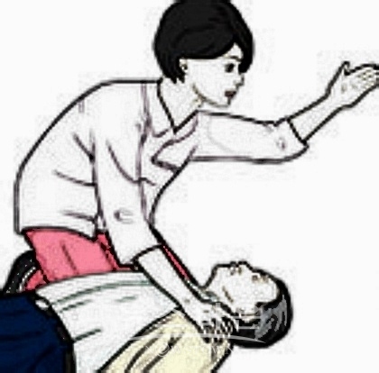 심폐소생술 이미지 사진