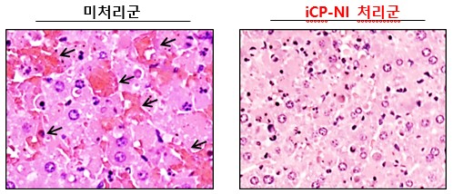 급성간염 동물모델에서 중증패혈증으로 손상된 간조직에 iCP-NI 처리 시 간세포 보호효능(미처리군 화살표: 간조직 혈관이 터져 용혈과 괴사가 관찰됨)