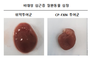 사진설명: 선천적 유전질환 - 비대성 심근증의 CP-FXN 치료 효능: 심장이 비대해지고 기능이 상실되는 (왼쪽) 것을 막고 심장기능을 정상화 (오른쪽) 시킴