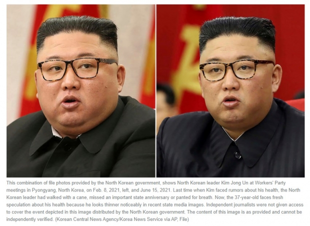 AP통신이 16일(현지시간) 보도한 북한 김정은 조선노동당 총서기의 사진. 외쪽 사진은 2021년 2월 8일, 오른쪽은 6월 15일 사진으로 조선중앙통신이 보도한 사진을 비교한 것이라고......
