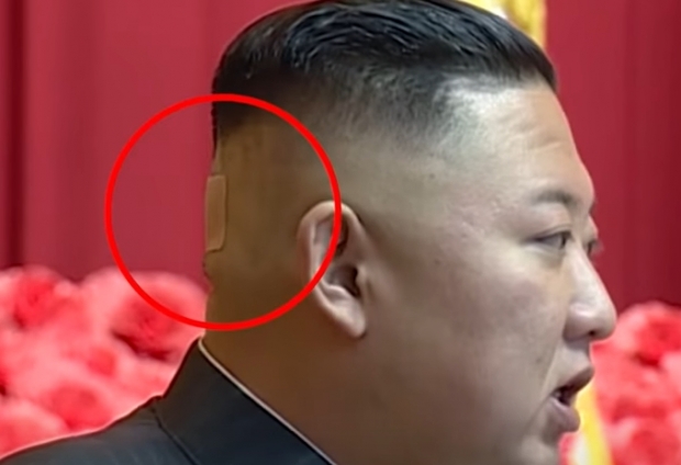 7월 30일 북한 관영매체 보도에서 7월 24~27일 강습회에 참석한 김정은 총비서 머리에 반창고가 붙여져 있다. 연합뉴스 캡처