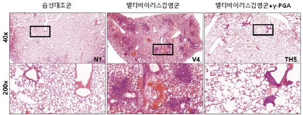 마우스 정상 폐조직(좌), 델타변이 코로나바이러스 감염 폐조직(중간), 감마-PGA 투여군 폐조직 (우)