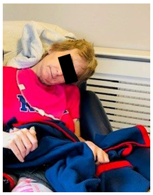 그림설명: 운동성이 떨어진 헌팅턴병(Huntington’s Disease) 환자가 휠체어에 몸을 고정한 모습