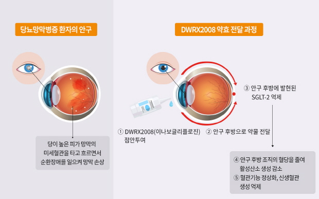 DWRX2008 점안 투여시 안구 내 약효 전달 과정