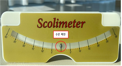 수은 함유 척추측만각도기