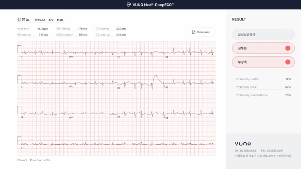 뷰노메드 딥ECG™ 운영화면 예시