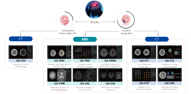 JLK Stroke Artificial Intelligence 제이엘케이 뇌졸중 전주기 풀 솔루션