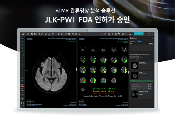 제이엘케이 뇌관류 MR 영상 분석 솔루션(JLK-PWI)