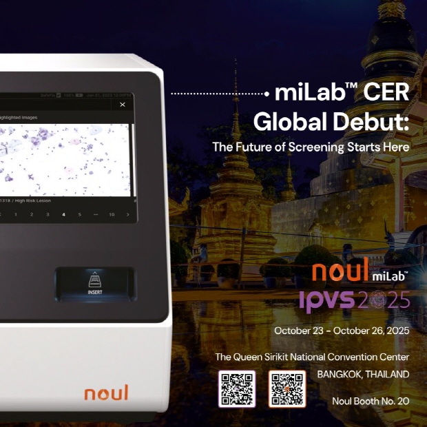 노을은 본격적인 miLab CER의 글로벌 시장 출고 시점에 맞춰 IPVS 2025에 참가하여 제품을 선보인다.